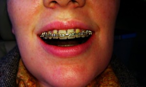 No more bands!